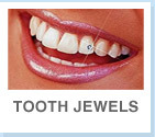 gallery/toothjewels