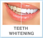 gallery/teethwhitening